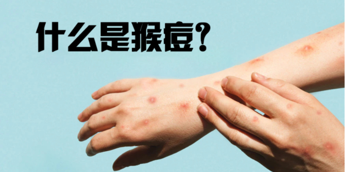 猴痘：它是什么，如何預(yù)防？